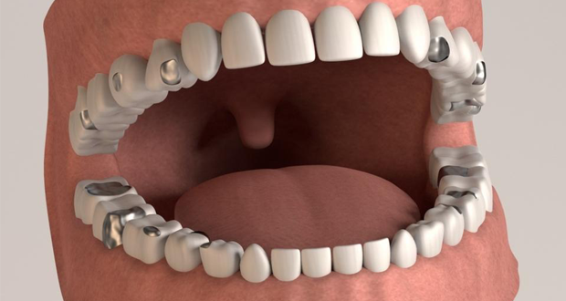 European Union agrees dental amalgam ban