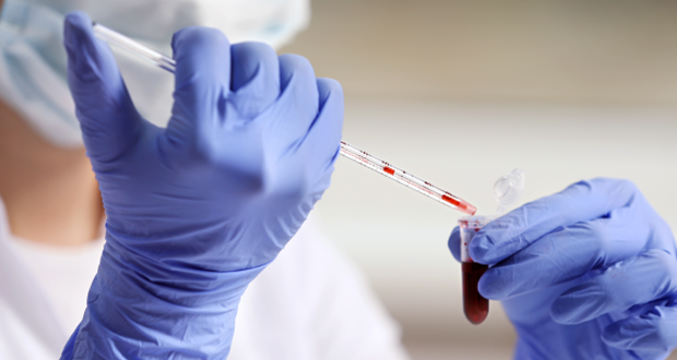 Blood test detects and locates cancer before symptoms appear