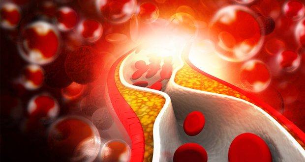 Hoge dosering vitamine D vermindert arteriële stijfheid