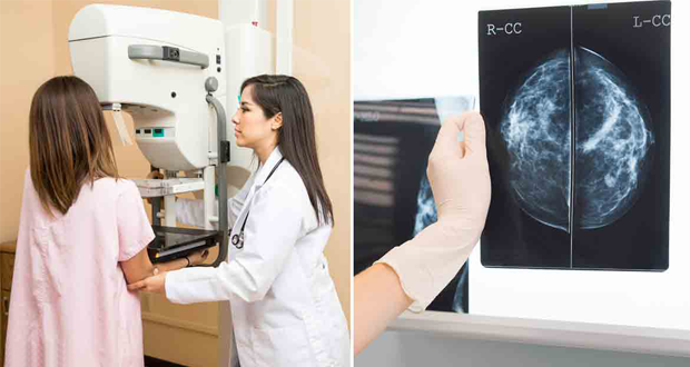 Mammografie redt geen levens