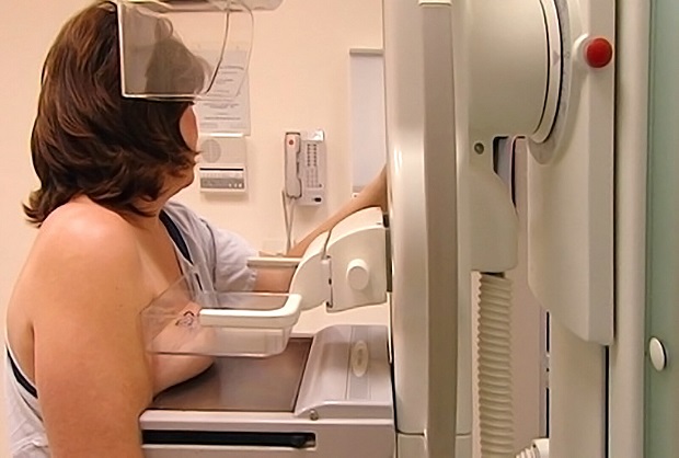 Mammografie voorkomt geen borstkanker