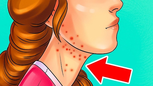 7 verrassende tekenen dat je te veel suiker eet