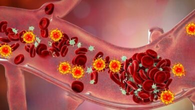 Hoge bloedsuiker leidt tot vaatvernauwing