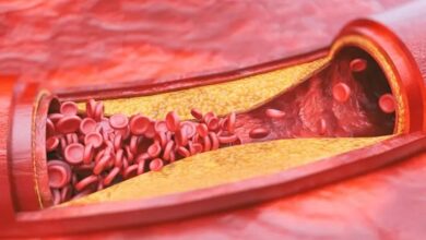 Vitamine D in hoge doses houdt slagaders soepel