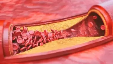Vitamine D in hoge doses houdt slagaders soepel