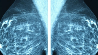 NAC-supplement remt borstkankergroei