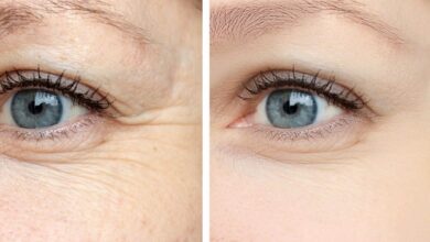 Er jonger uitzien zonder botox of crèmes?