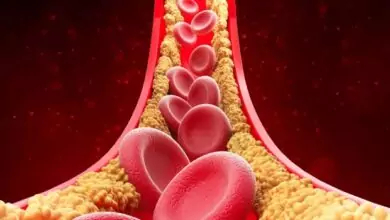 Je arts heeft het mis over cholesterol