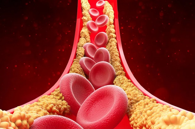 Je arts heeft het mis over cholesterol