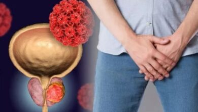 Vergrote prostaat natuurlijk verkleinen