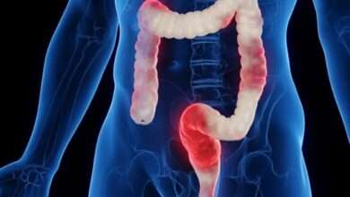 De snelste thuis-test voor darmklachten zoals Crohn, PDS, coeliakie en colitis ulcerosa